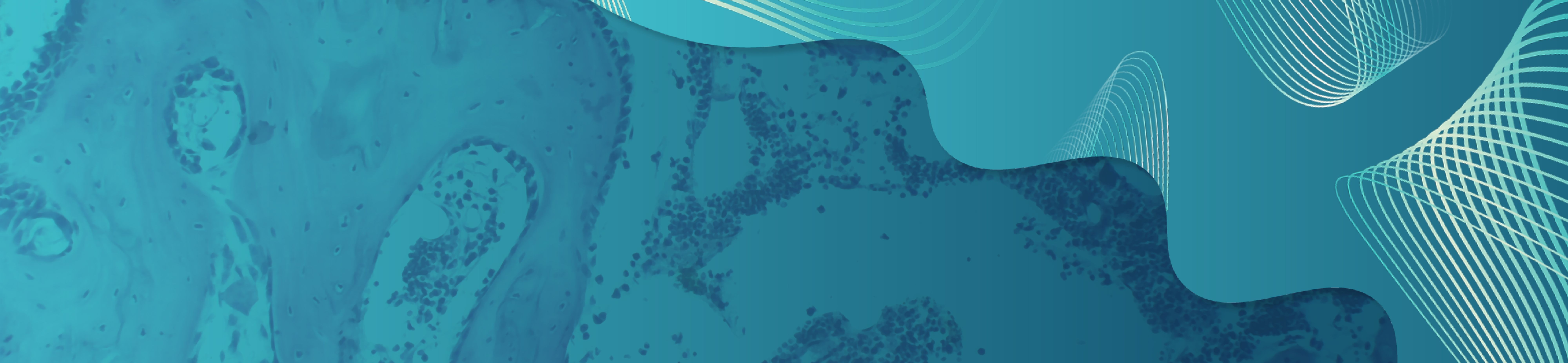 Recognizing the Profound Impact on Quality of Life: Emerging Therapy Options for Patients with Myelofibrosis